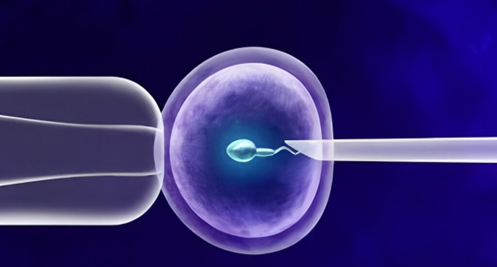 美国代孕：试管成功率：照亮我生命的那束光